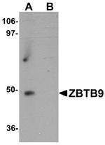 ZBTB9 Antibody in Western Blot (WB)