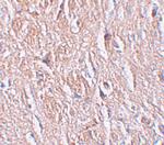 LRRTM4 Antibody in Immunohistochemistry (IHC)