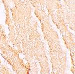 VPS39 Antibody in Immunohistochemistry (IHC)