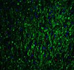 GLS2 Antibody in Immunohistochemistry (IHC)