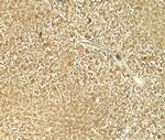 GLS2 Antibody in Immunohistochemistry (IHC)