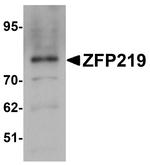 ZNF219 Antibody in Western Blot (WB)