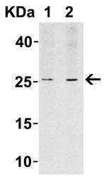 LIF Antibody in Western Blot (WB)