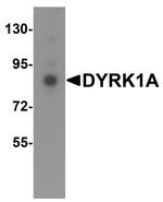 DYRK1A Antibody in Western Blot (WB)