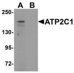 ATP2C1 Antibody in Western Blot (WB)