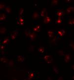 ATP2C2 Antibody in Immunocytochemistry (ICC/IF)