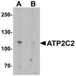 ATP2C2 Antibody in Western Blot (WB)