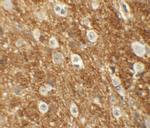 ROCK2 Antibody in Immunohistochemistry (IHC)