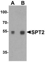 SPTLC2 Antibody in Western Blot (WB)