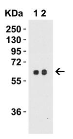 SPTLC2 Antibody in Western Blot (WB)