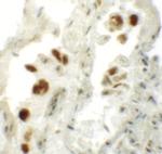 NUMB Antibody in Immunohistochemistry (IHC)