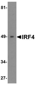 IRF4 Antibody in Western Blot (WB)