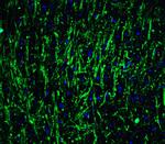 MSI2 Antibody in Immunohistochemistry (IHC)