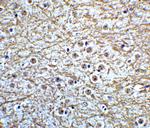 MSI2 Antibody in Immunohistochemistry (IHC)