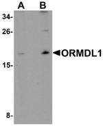 ORMDL1 Antibody in Western Blot (WB)