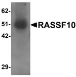 RASSF10 Antibody in Western Blot (WB)