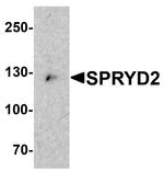 SPRYD2 Antibody in Western Blot (WB)