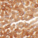 HDGFRP2 Antibody in Immunohistochemistry (IHC)