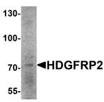 HDGFRP2 Antibody in Western Blot (WB)