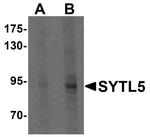 SYTL5 Antibody in Western Blot (WB)