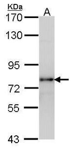 LHR Antibody in Western Blot (WB)