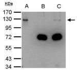 DDB1 Antibody in Immunoprecipitation (IP)