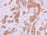 NQO1 Antibody in Immunohistochemistry (Paraffin) (IHC (P))