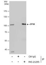 EPS8 Antibody in Immunoprecipitation (IP)