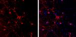 GAD65 Antibody in Immunocytochemistry (ICC/IF)