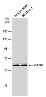 GAD65 Antibody in Western Blot (WB)