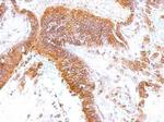 GEM Antibody in Immunohistochemistry (Paraffin) (IHC (P))