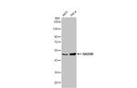 HADHB Antibody in Western Blot (WB)