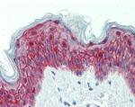 GALR2 Antibody in Immunohistochemistry (Paraffin) (IHC (P))