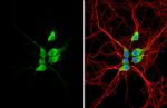 GALR2 Antibody in Immunocytochemistry (ICC/IF)