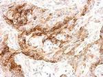 GALR2 Antibody in Immunohistochemistry (Paraffin) (IHC (P))