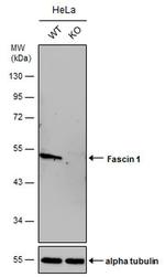 Fascin Antibody