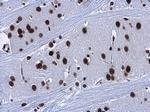 HMGA2 Antibody in Immunohistochemistry (Paraffin) (IHC (P))