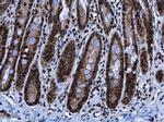 HMGA2 Antibody in Immunohistochemistry (Paraffin) (IHC (P))