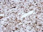 HMGA2 Antibody in Immunohistochemistry (Paraffin) (IHC (P))