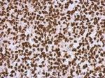 HMGA2 Antibody in Immunohistochemistry (Paraffin) (IHC (P))