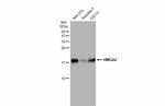 HMGA2 Antibody in Western Blot (WB)