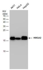 HMGA2 Antibody in Western Blot (WB)