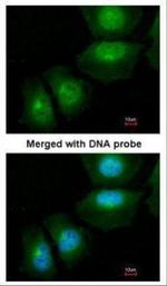 S100A11 Antibody in Immunocytochemistry (ICC/IF)