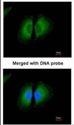 Kininogen 1 Antibody in Immunocytochemistry (ICC/IF)