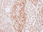 Kininogen 1 Antibody in Immunohistochemistry (Paraffin) (IHC (P))