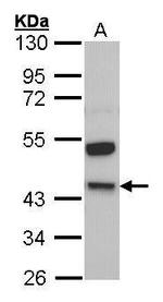 Kininogen 1 Antibody in Western Blot (WB)