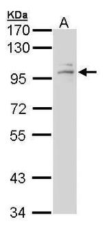 Glucocorticoid Receptor Antibody in Western Blot (WB)