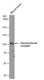 Glucocorticoid Receptor Antibody in Western Blot (WB)