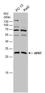 HPRT1 Antibody in Western Blot (WB)