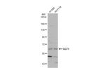 GGT1 Antibody in Western Blot (WB)